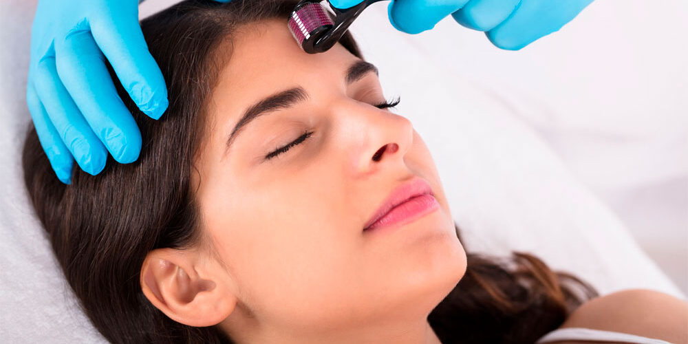 Что-такое-микронидлинг-и-чем-он-хорош-для-кожи