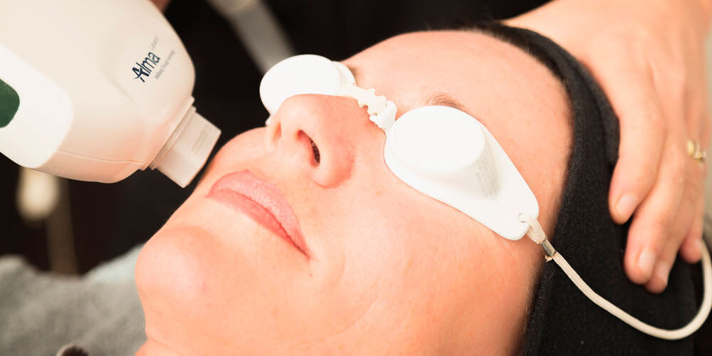 Электропорация-—-безболезненный-метод-омоложения-кожи Электропорация