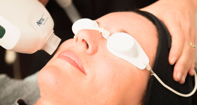 Электропорация-—-безболезненный-метод-омоложения-кожи Электропорация