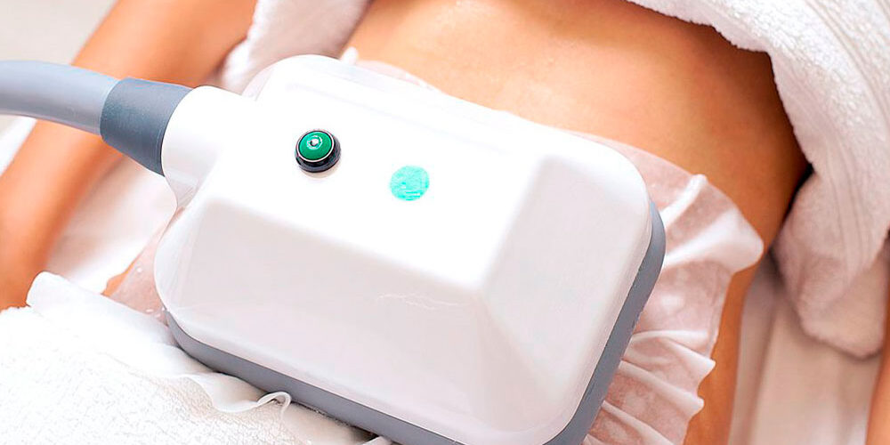 Криолиполиз