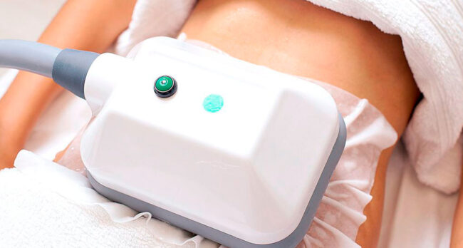 Криолиполиз