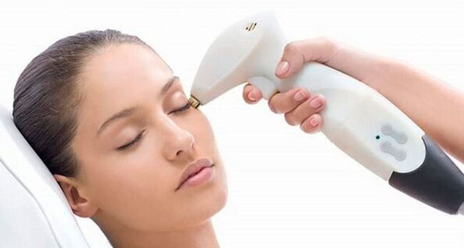 Современная-методика-омоложения-кожи-—-лазерная-наноперфораци лазерная-наноперфорация