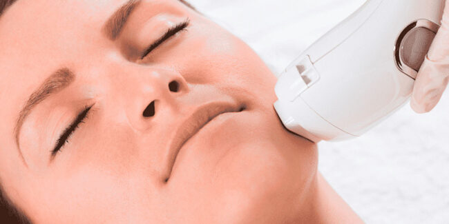 Фракционное-лазерное-омоложение Фракционное